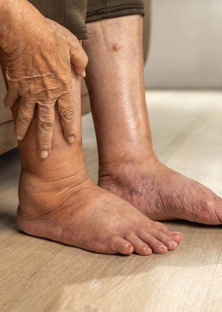 Our Services diabetic foot conditions Treatment for diabetic foot conditions and complications